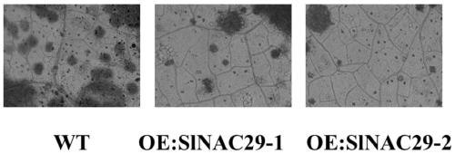 Application of slnac29 Gene in Improving Tomato Bacterial Leaf Spot Resistance and Drought Tolerance