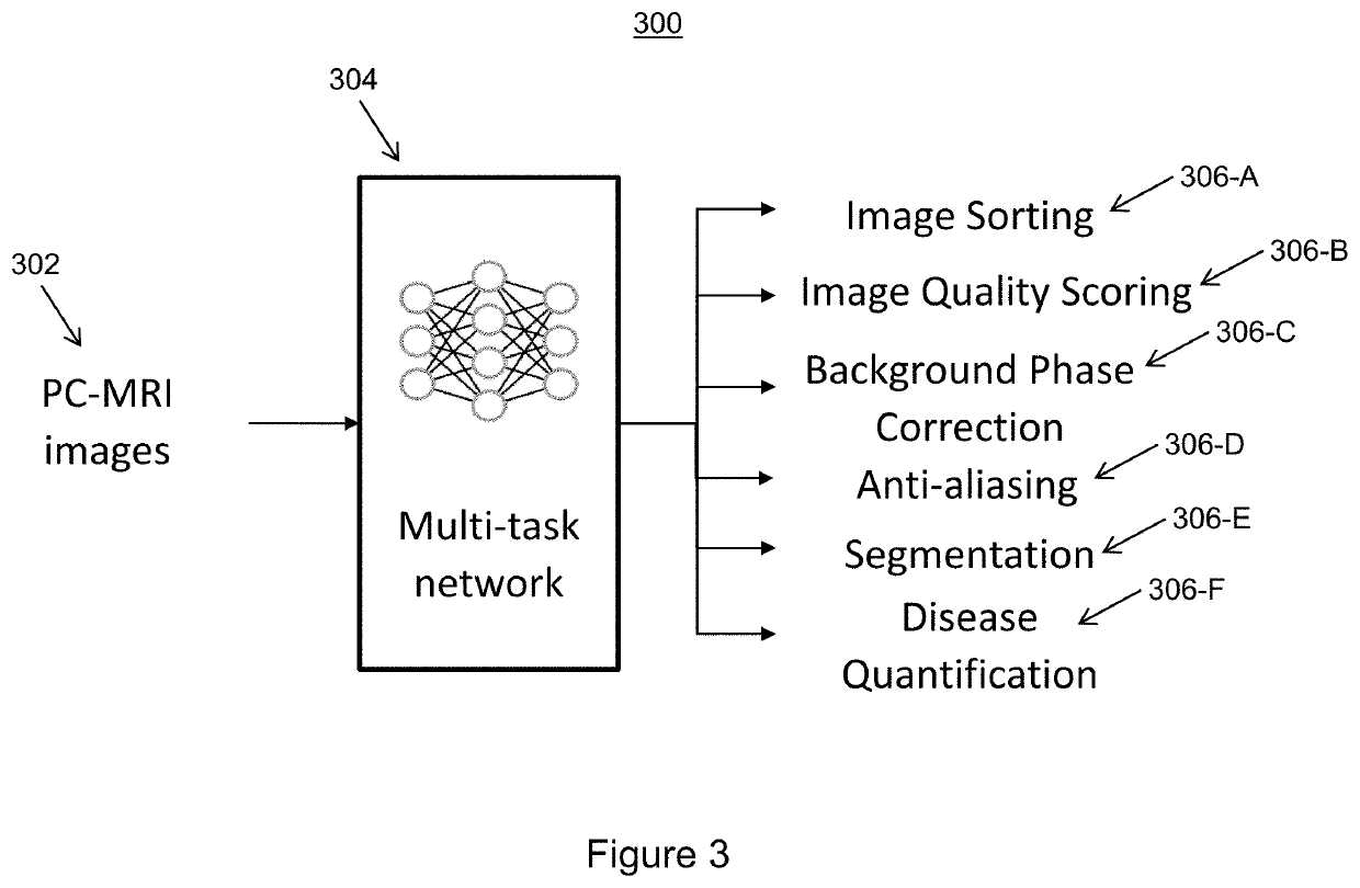 Fully automatic inline processing for pc-mri imagesfully automatic inline processing for pc-mri images using machine learning