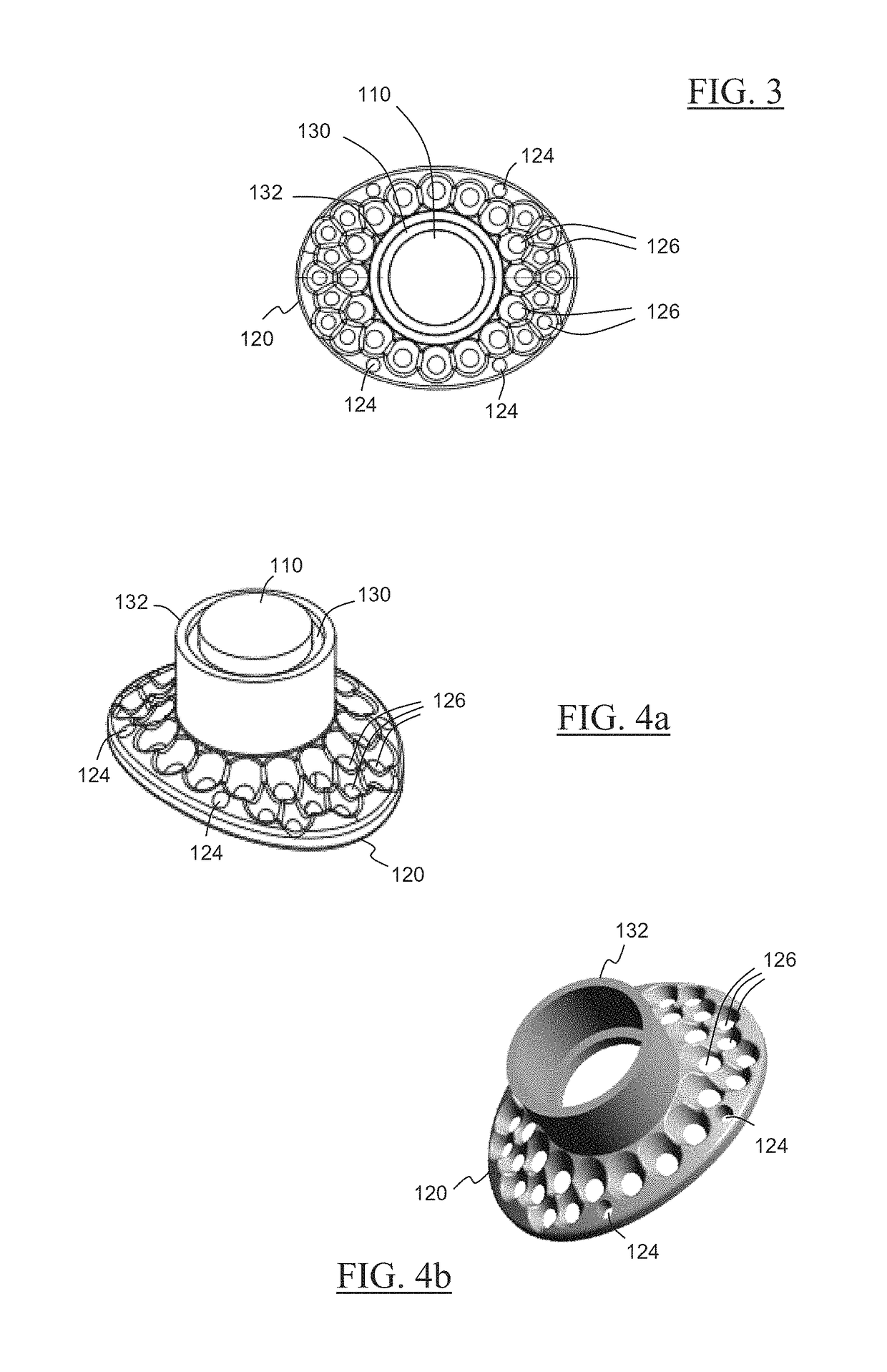 Keratoprosthesis, and system and method of corneal repair using same