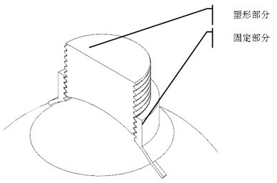 Corneal shaping device for correcting myopia