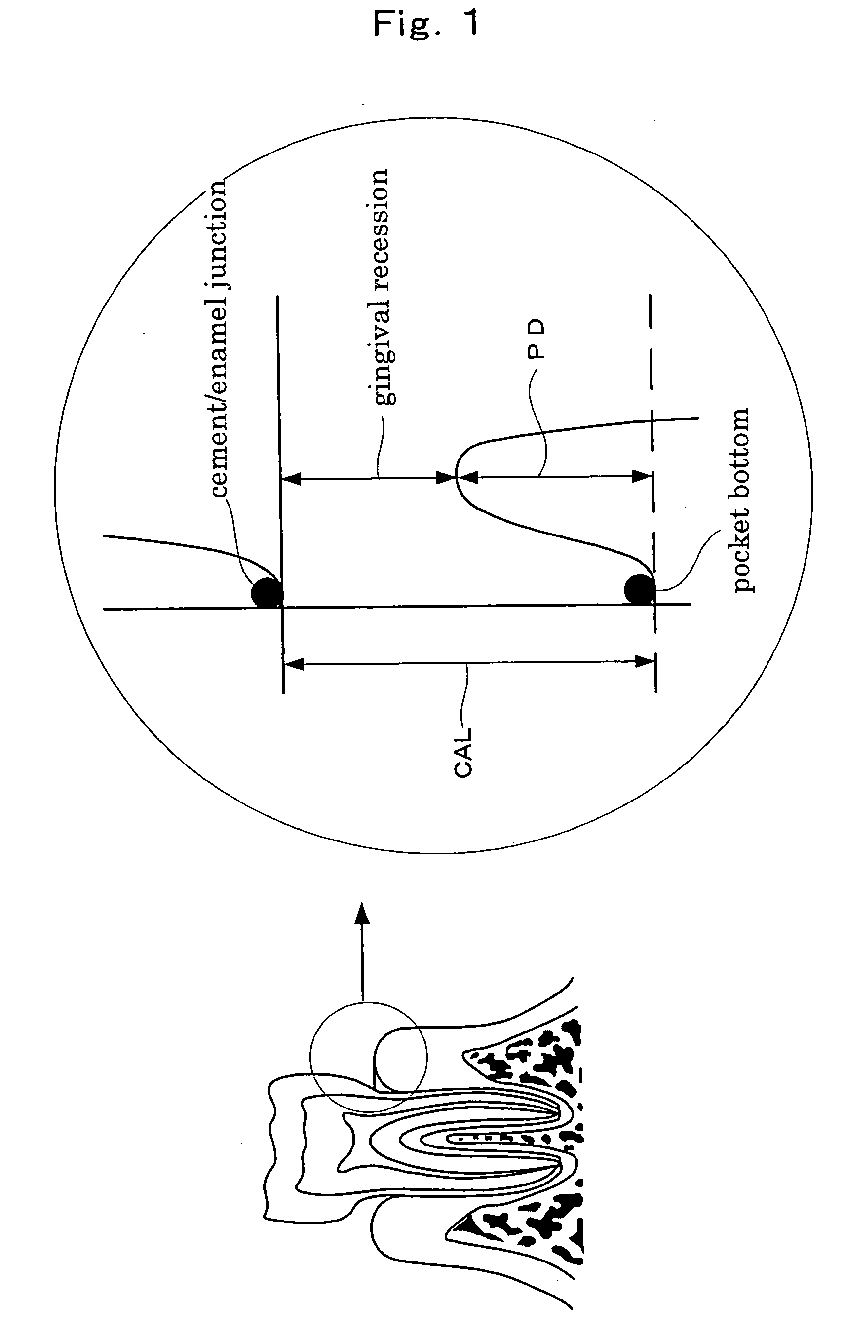 Method of inhibiting alveolar bone resorption and periodontal membrane loss and composition for internal use to be used therein