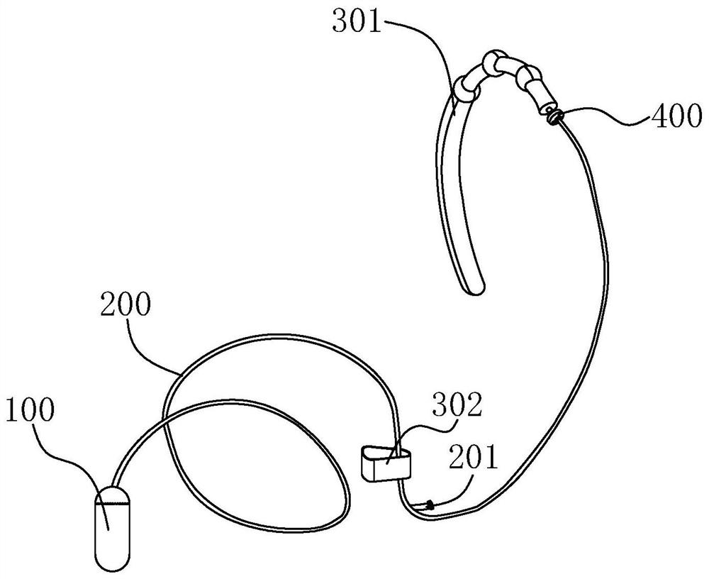 Esophageal local drug delivery device for acute radiation esophagitis