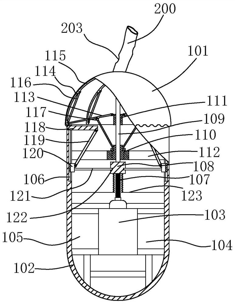 Esophageal local drug delivery device for acute radiation esophagitis