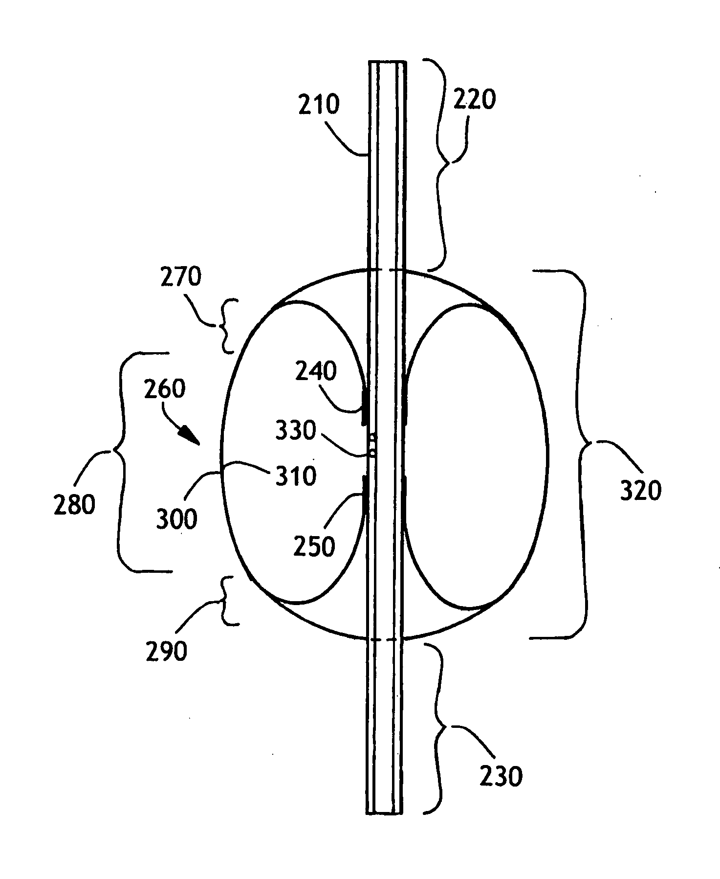 Toroidal endotracheal cuffs for ventilator associated pneumonia reduction