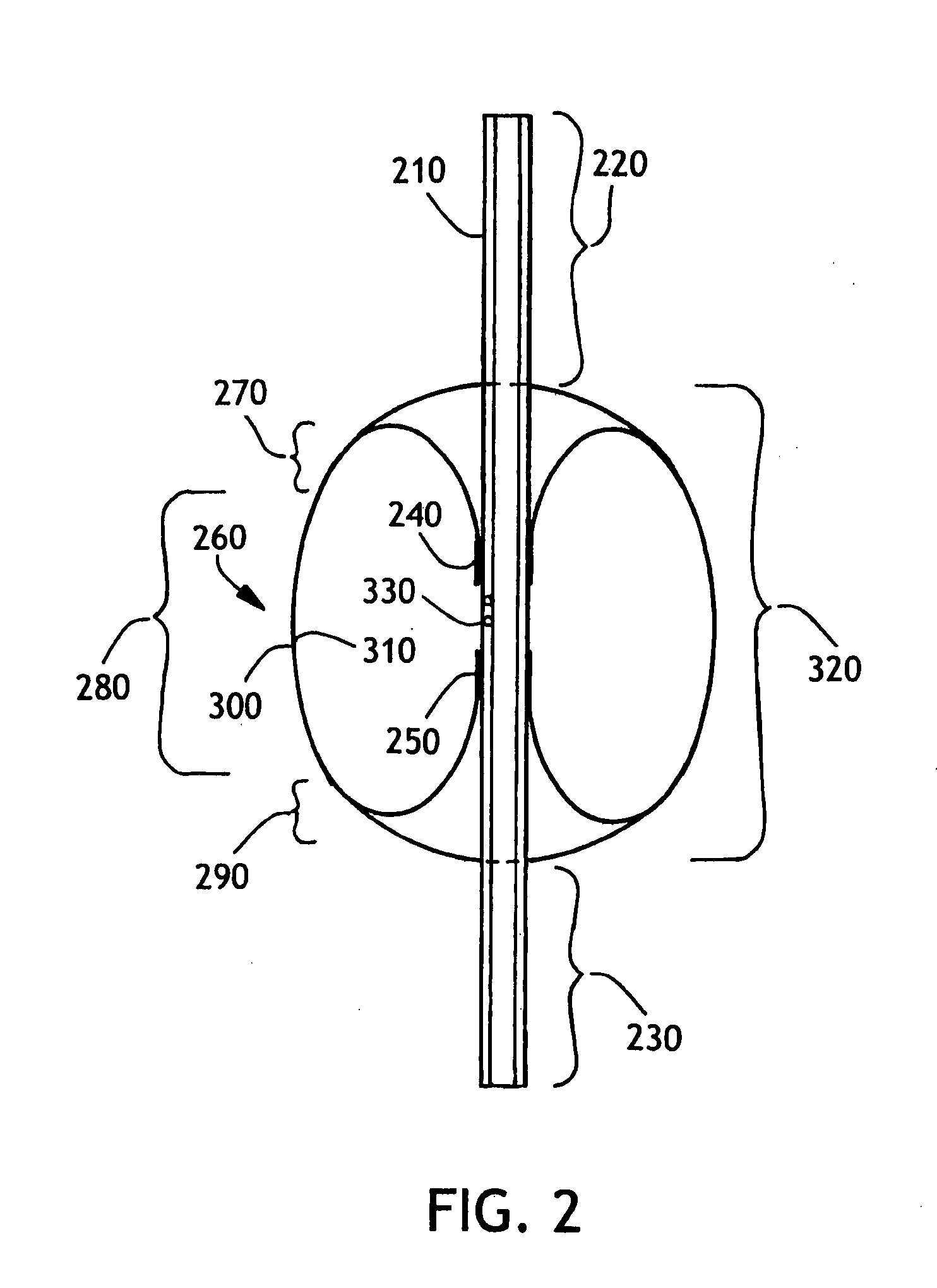 Toroidal endotracheal cuffs for ventilator associated pneumonia reduction