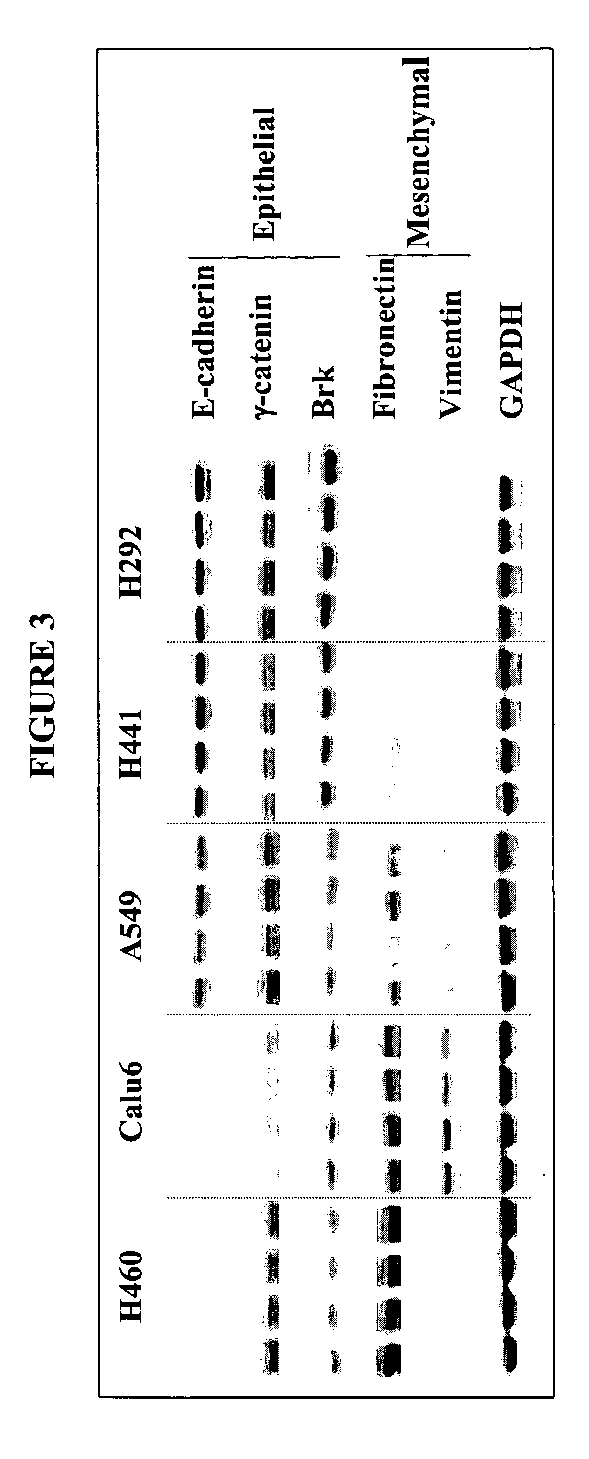 Biological Markers Predictive Of Anti-Cancer Response To Insulin-like Growth Factor-1 Receptor Kinase Inhibitors