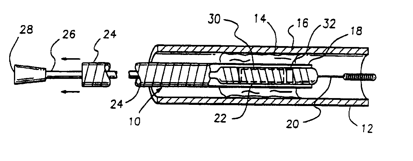 Apparatus for restenosis treatment