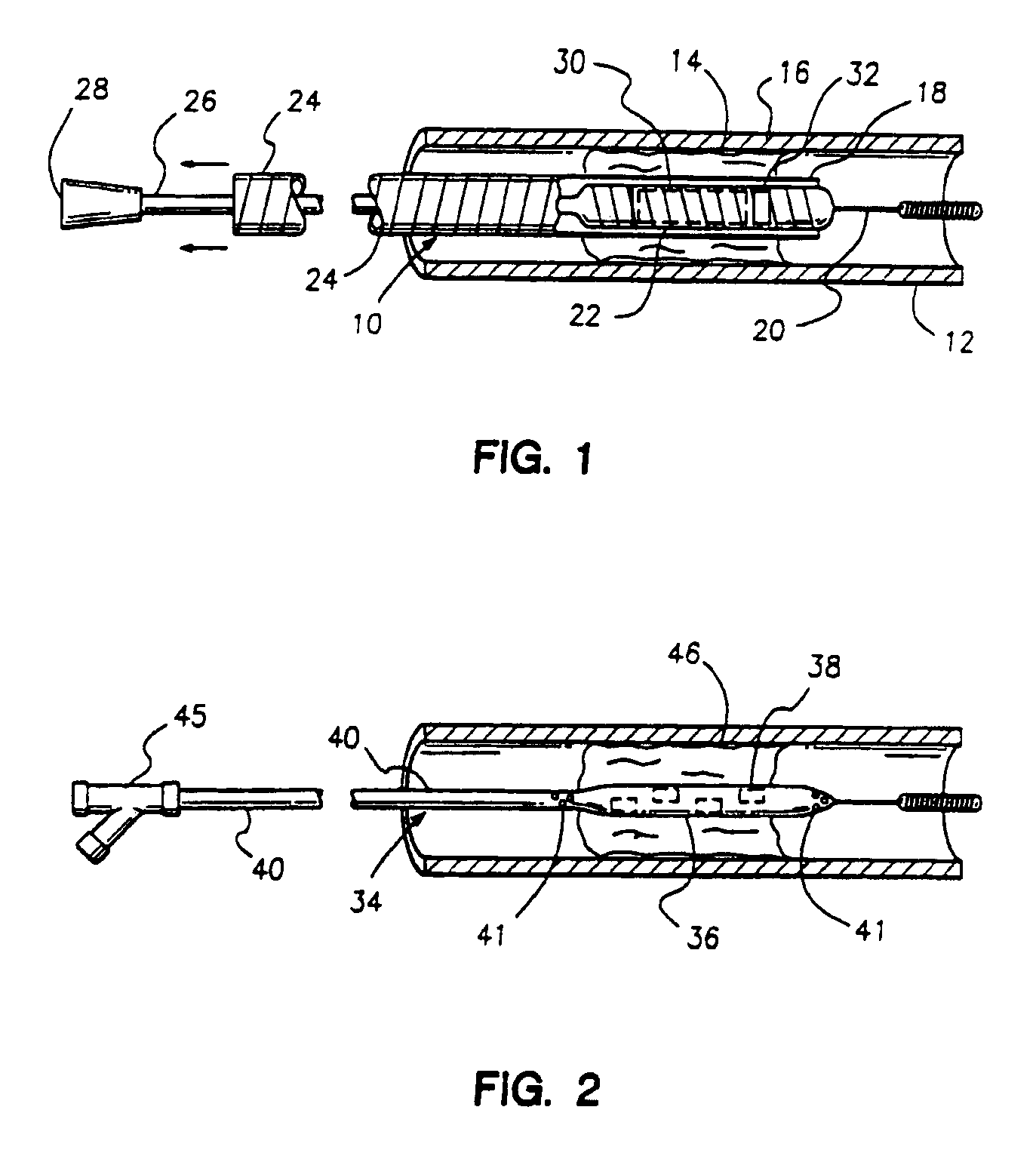 Apparatus for restenosis treatment