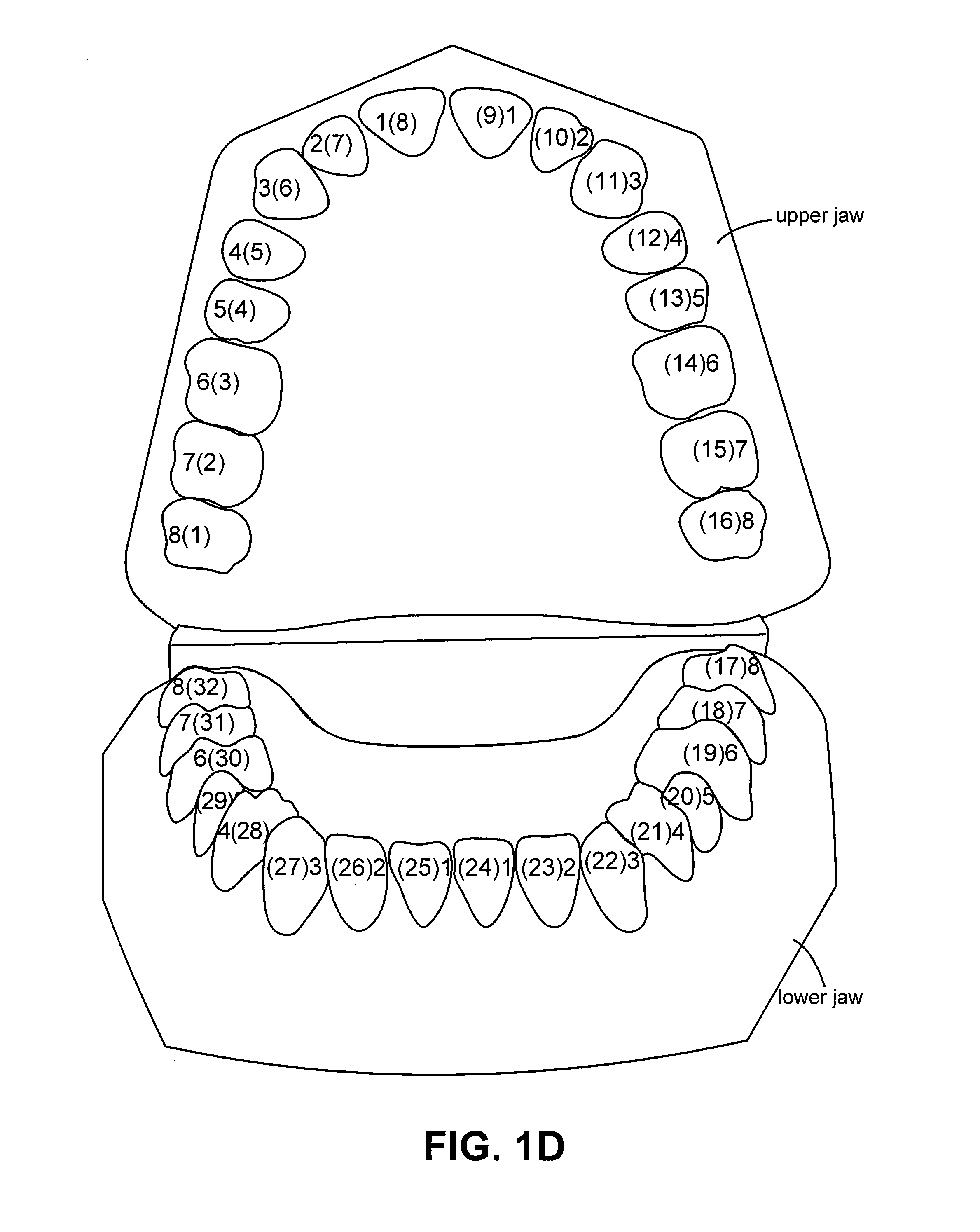 System and method for positioning three-dimensional brackets on teeth