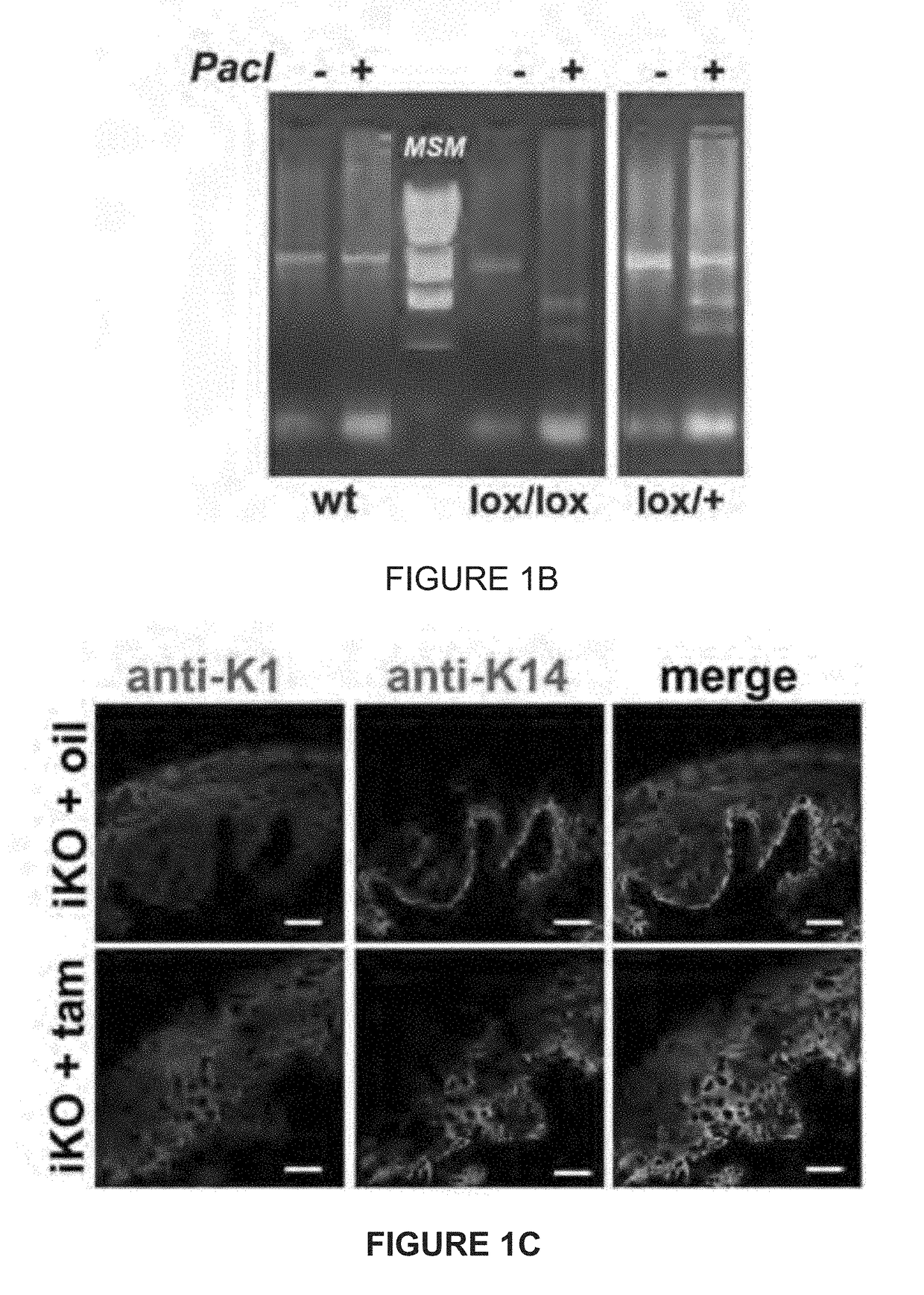 Trpa1 and trpv4 inhibitors and methods of using the same for organ-specific inflammation and itch