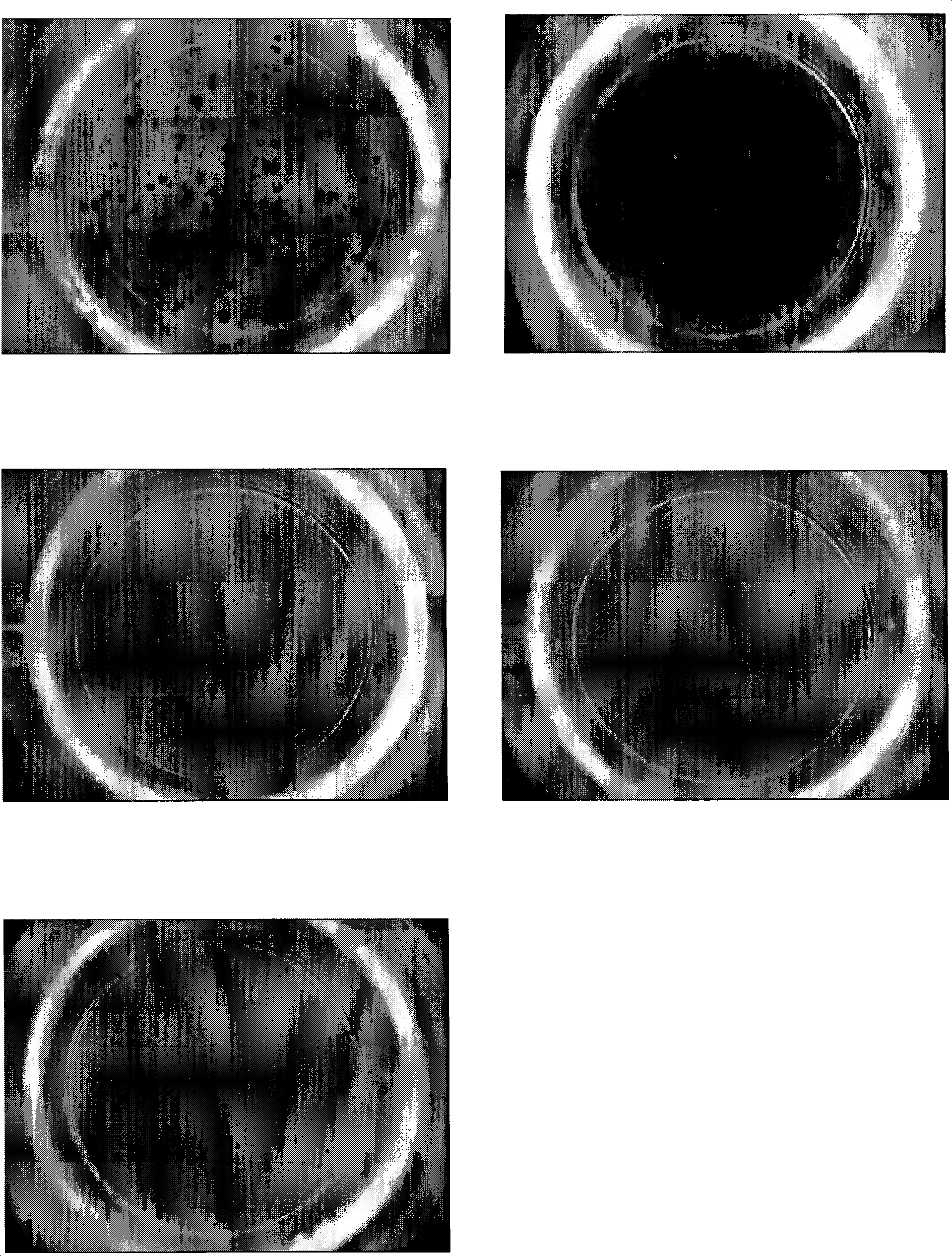 Reagent for detecting tubercle bacillus infection in vitro and method thereof