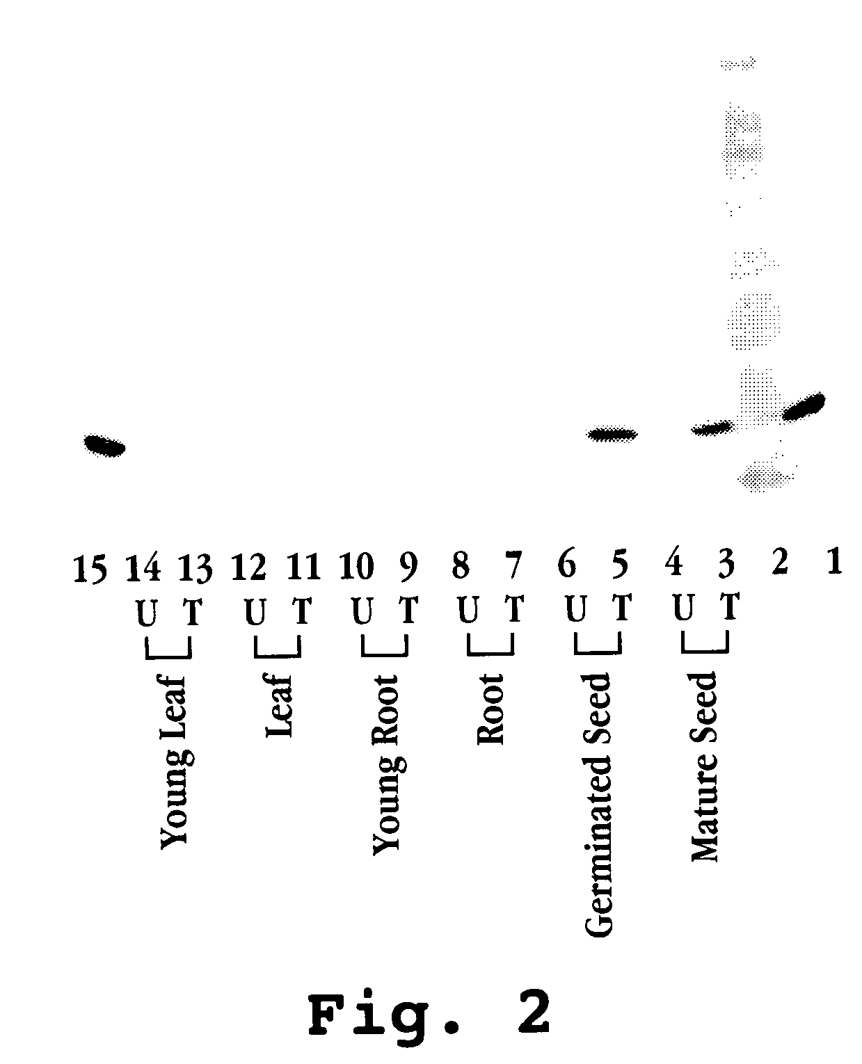 Expression of human milk proteins in transgenic plants