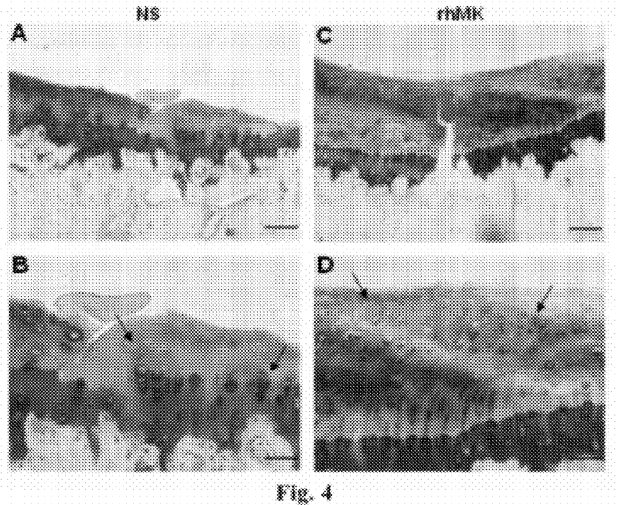 The use of midkine protein and the protein-containing medical device