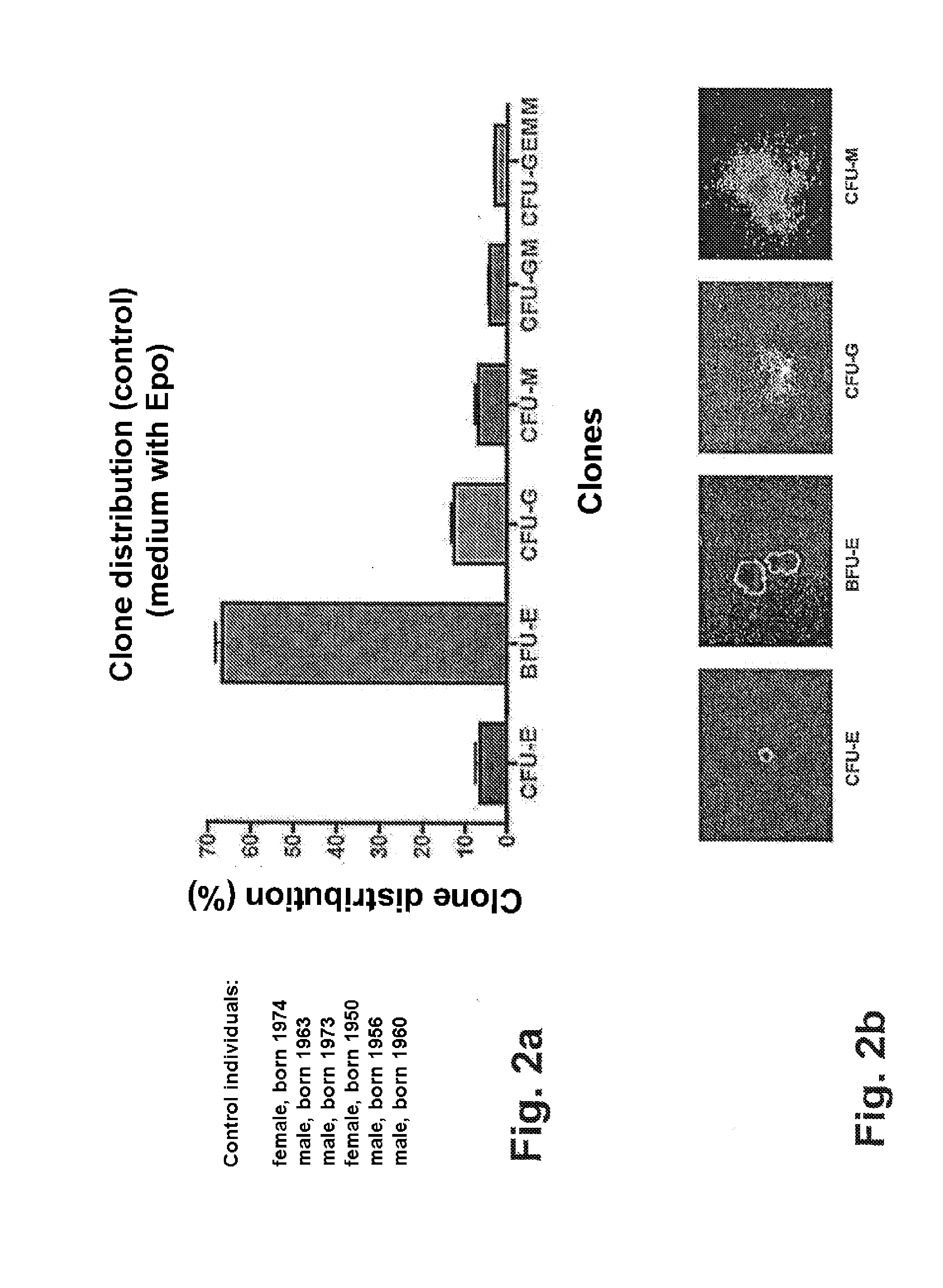 Method for diagnosing and/or predicting the development of neurodegenerative diseases