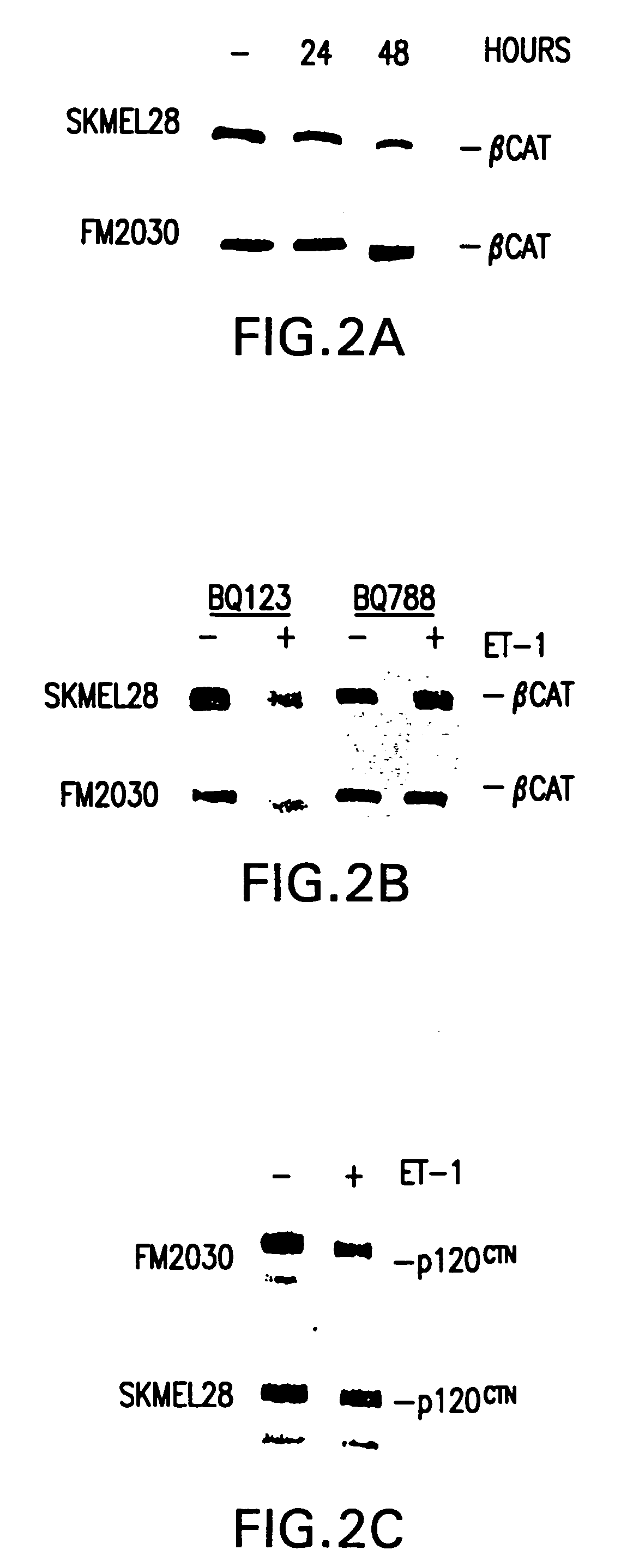 Cancer treatment with endothelin receptor antagonists