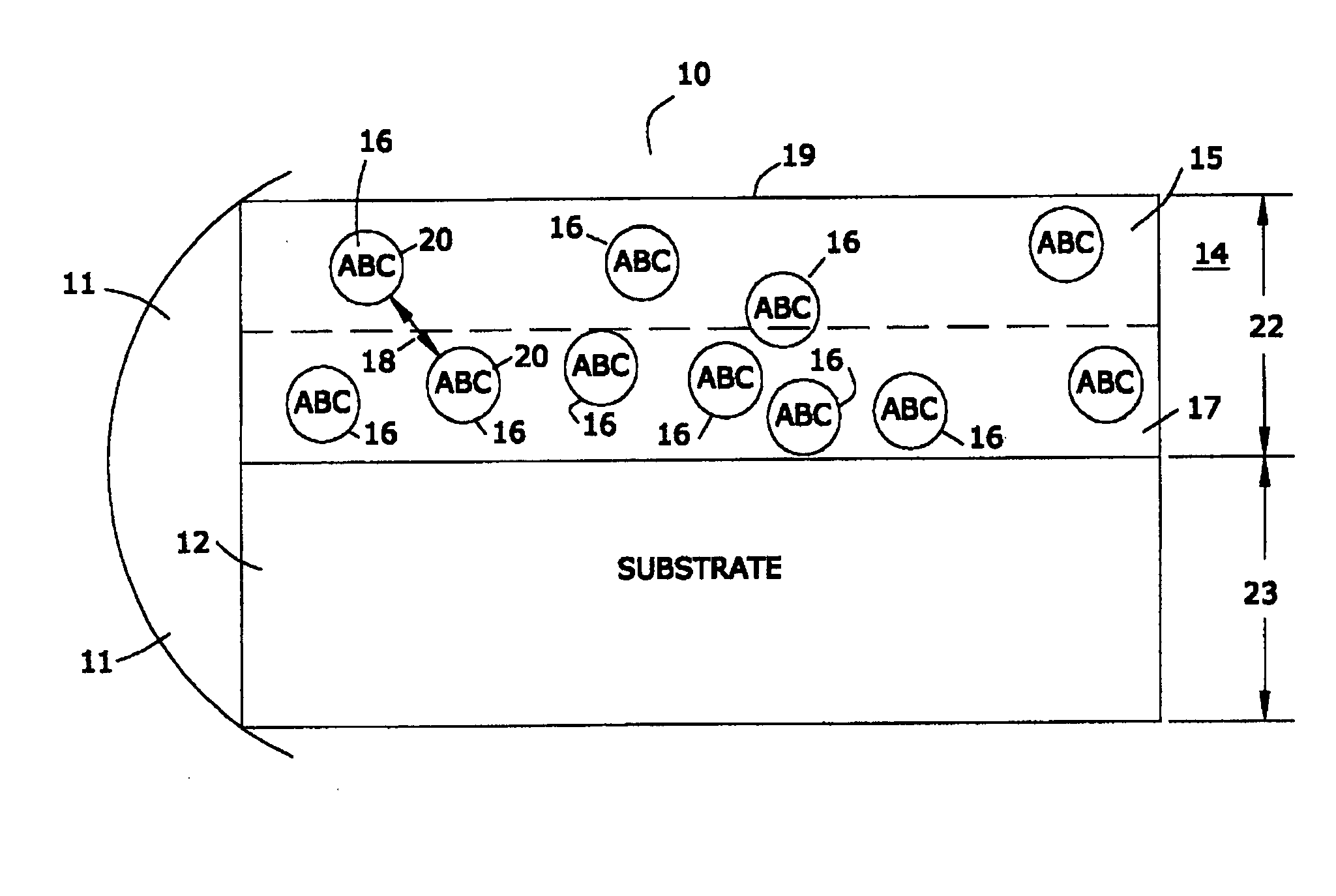 Implantable medical device