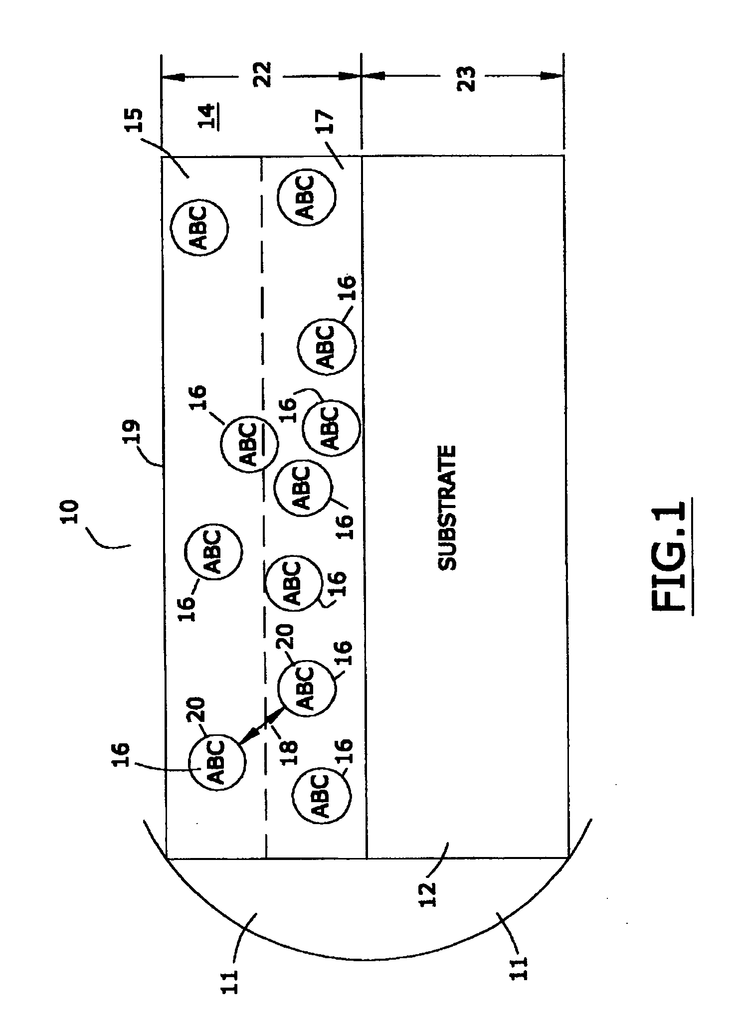 Implantable medical device