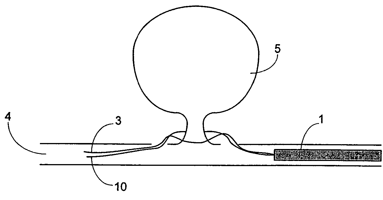 Device and methods for non-surgical clipping of aneurysms