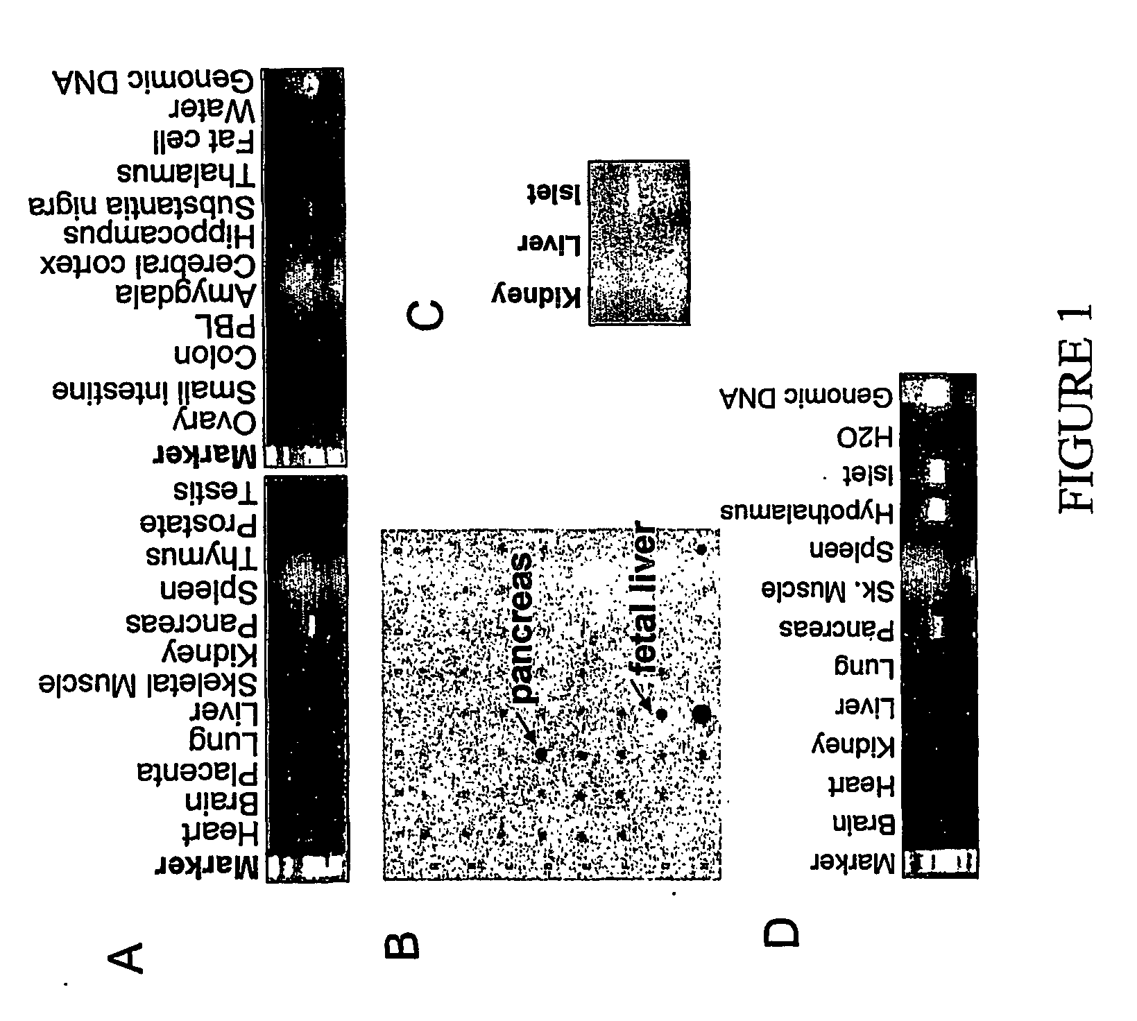 Phenyl-and pyridylpiperidine-derivatives as modulators of glucose metabolism