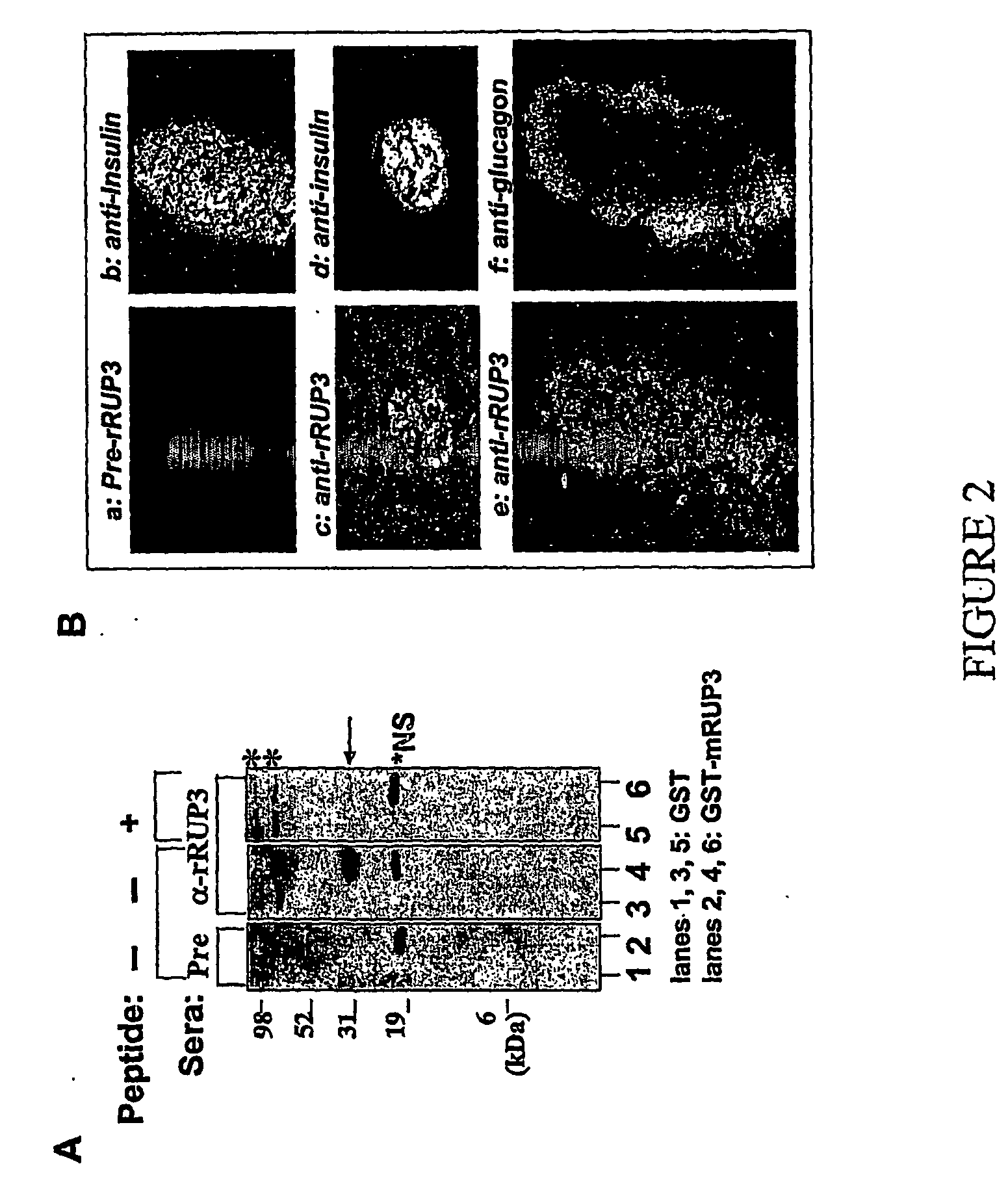 Phenyl-and pyridylpiperidine-derivatives as modulators of glucose metabolism