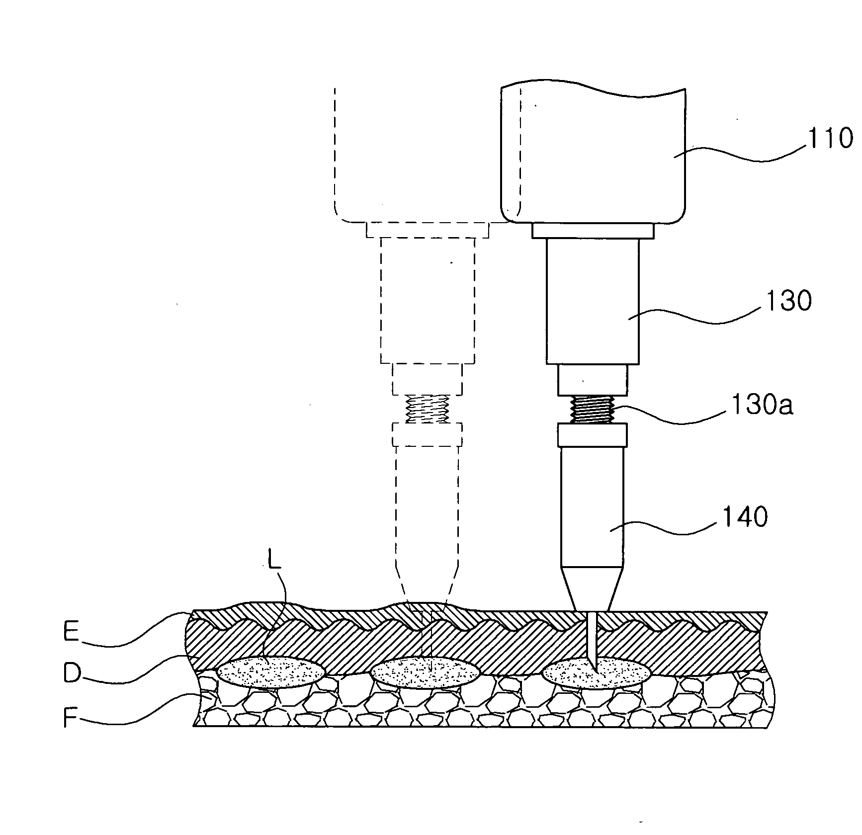 Injection method using injector with length-adjustable needle and injection apparatus using the same