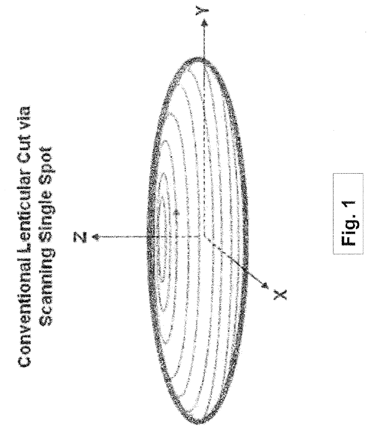 Systems and methods for lenticular laser incision