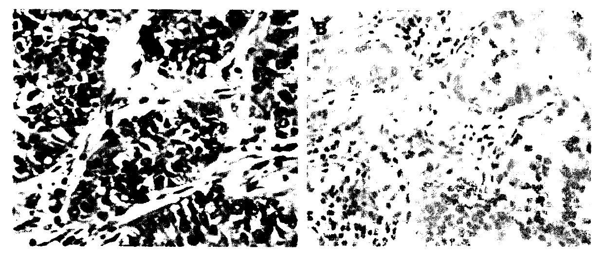 Preparation of rabbit anti-human TRK protein monoclonal antibody and immunohistochemical application thereof