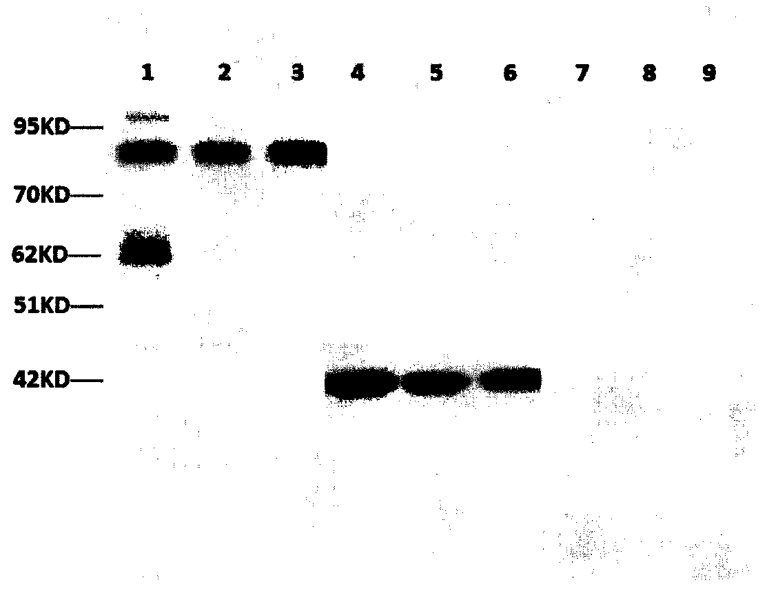 Preparation of rabbit anti-human TRK protein monoclonal antibody and immunohistochemical application thereof