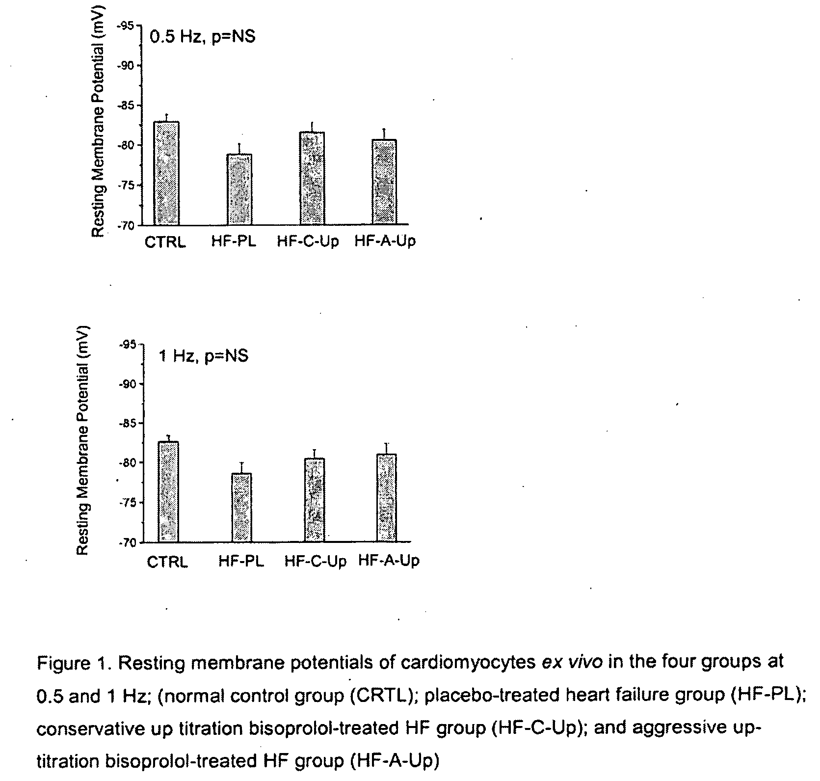 Treatment of heart disease using beta-blockers