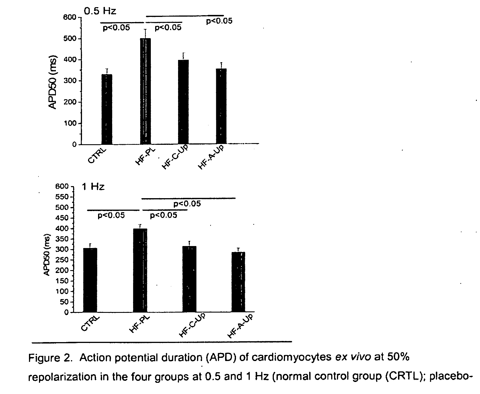 Treatment of heart disease using beta-blockers