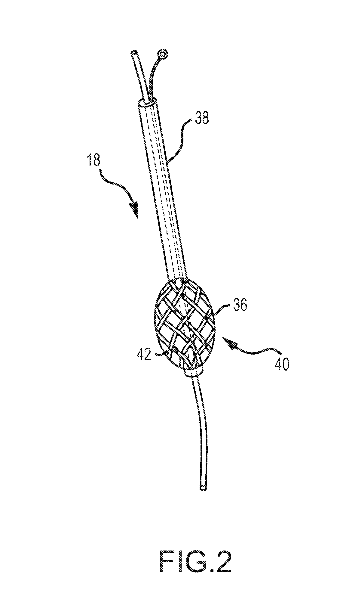 System for optimized coupling of ablation catheters to body tissues and evaulation of lesions formed by the catheters