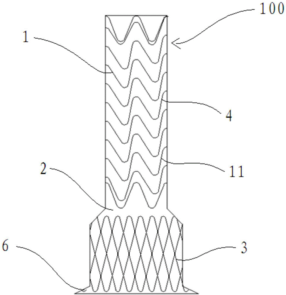 Aortic windowing branch covered stent