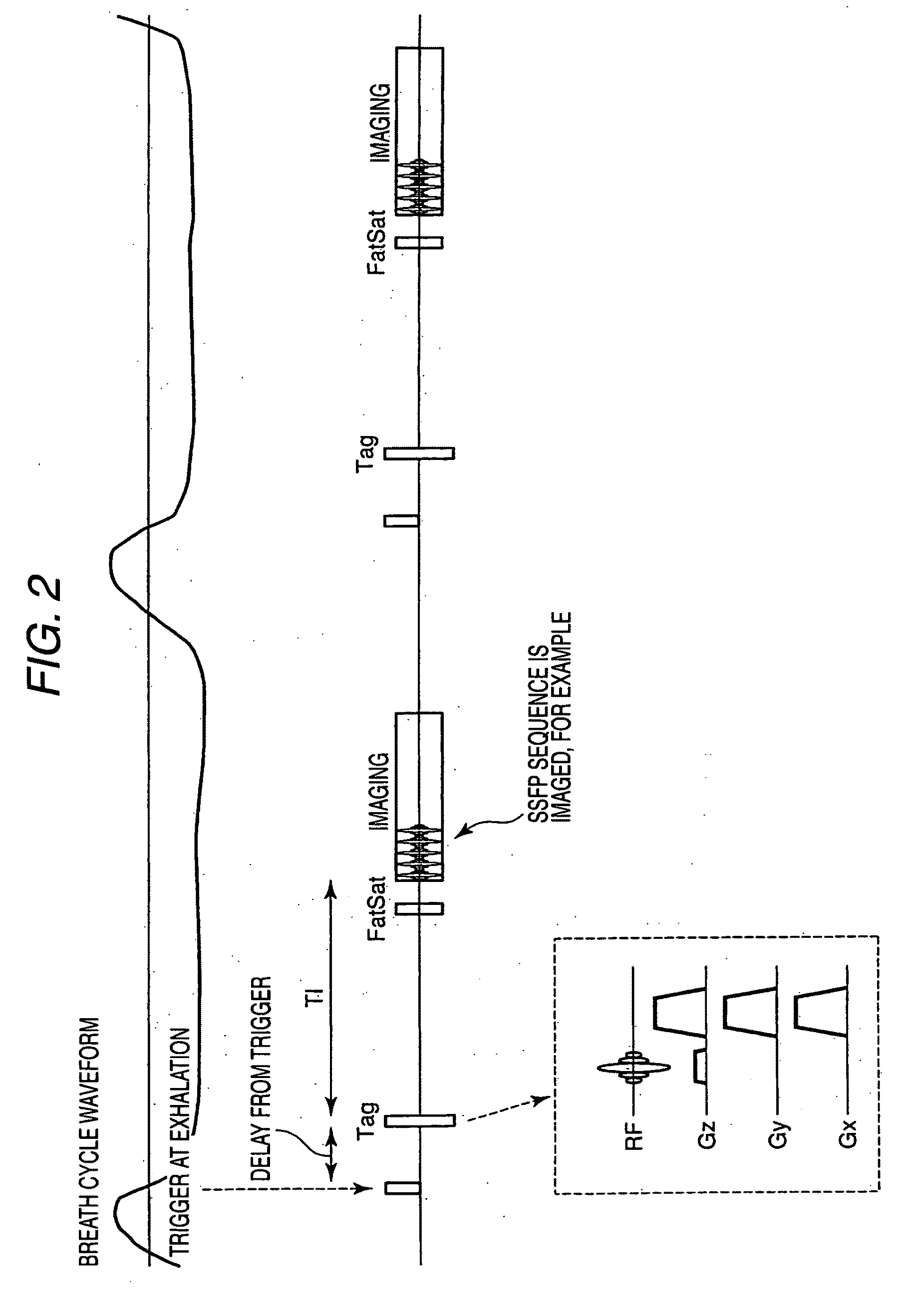 Magnetic resonance imaging apparatus and magnetic resonance imaging method