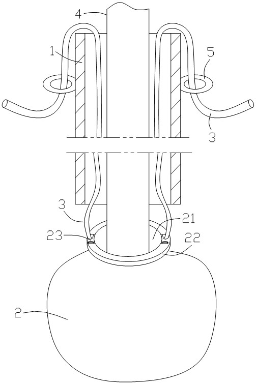 Disposable dissemination-preventing and tumor-smashing device