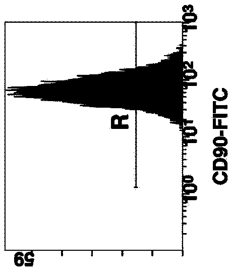 Method for cultivating autologous umbilical cord mesenchymal stem cells by adopting human umbilical cord blood rich platelet lysate