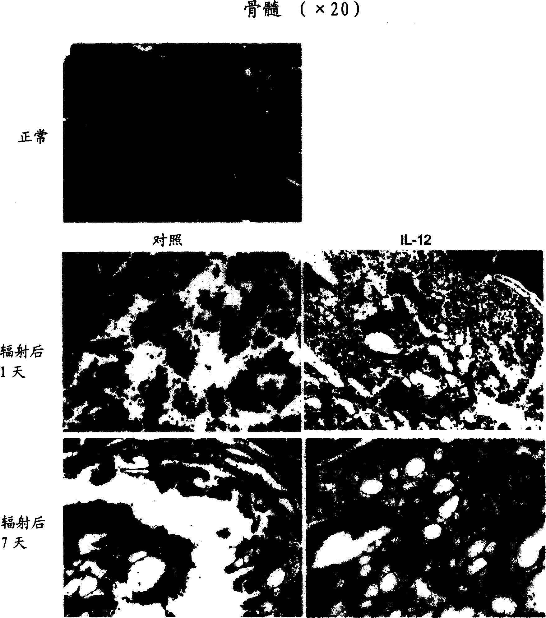 Therapeutic agent to recover hematopoiesis function and its compositions and usage