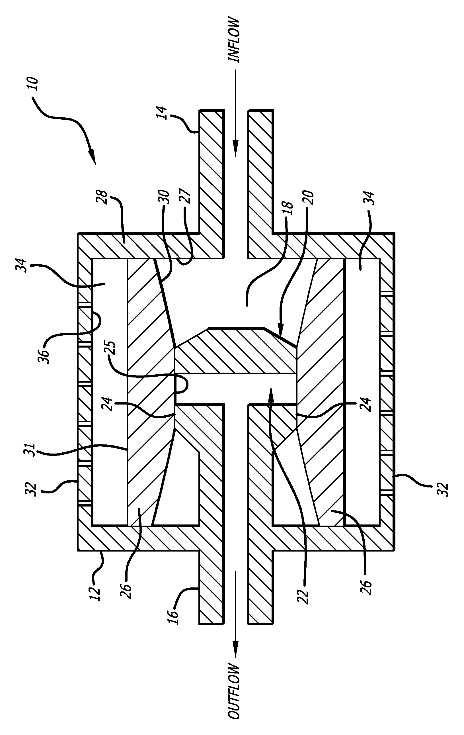 Shunt valve for controlling siphon effect