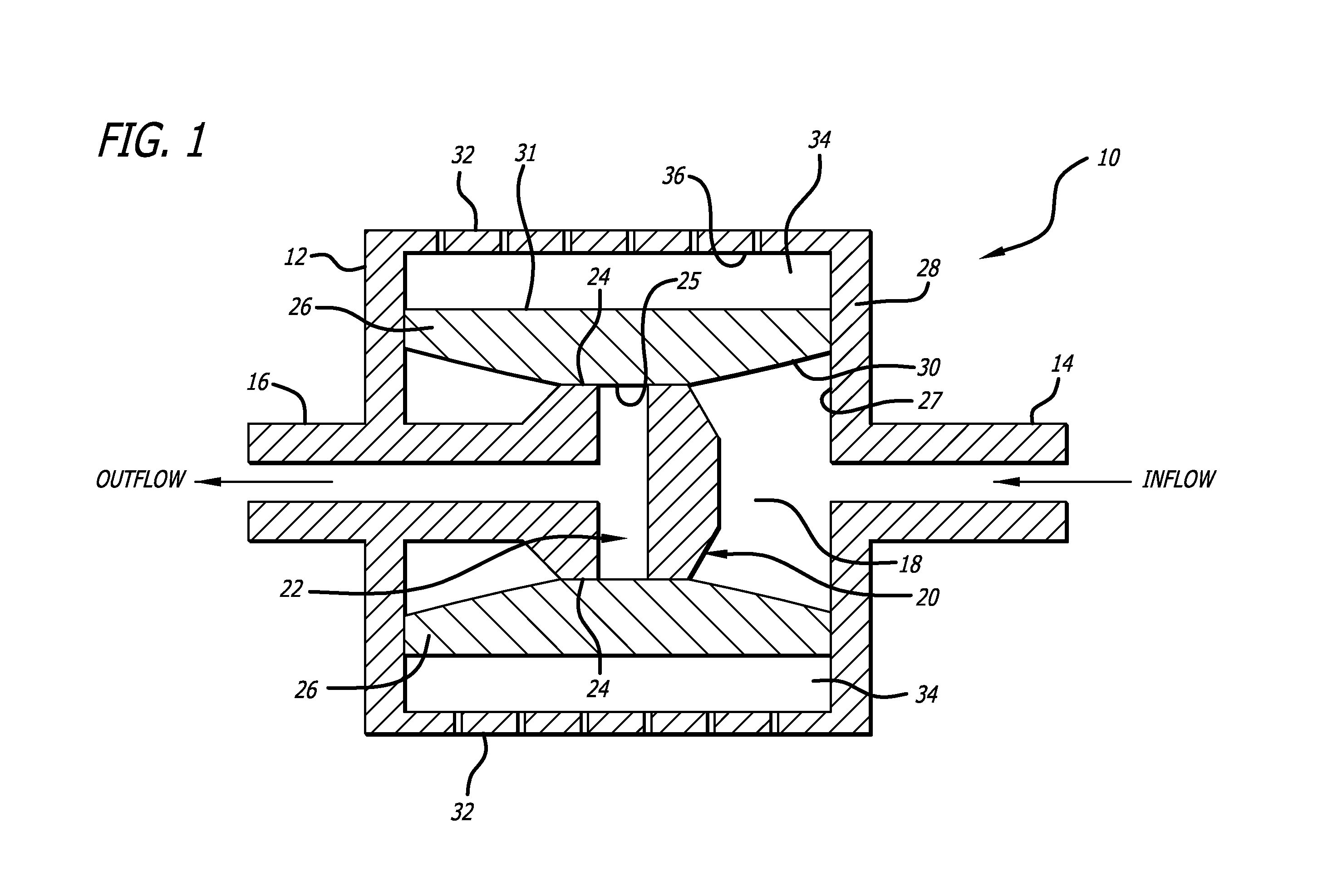 Shunt valve for controlling siphon effect