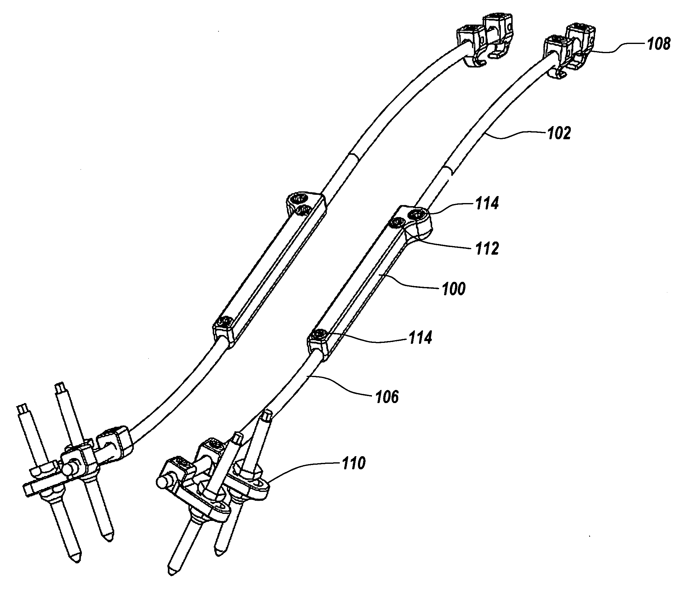 Adjustable length implant