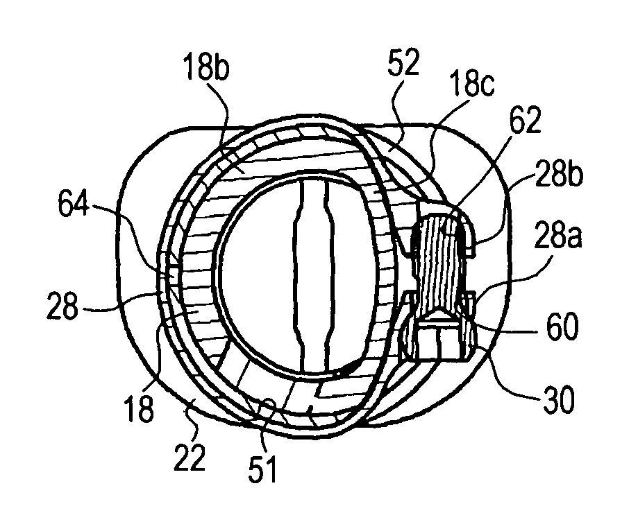 Distractible intervertebral implant