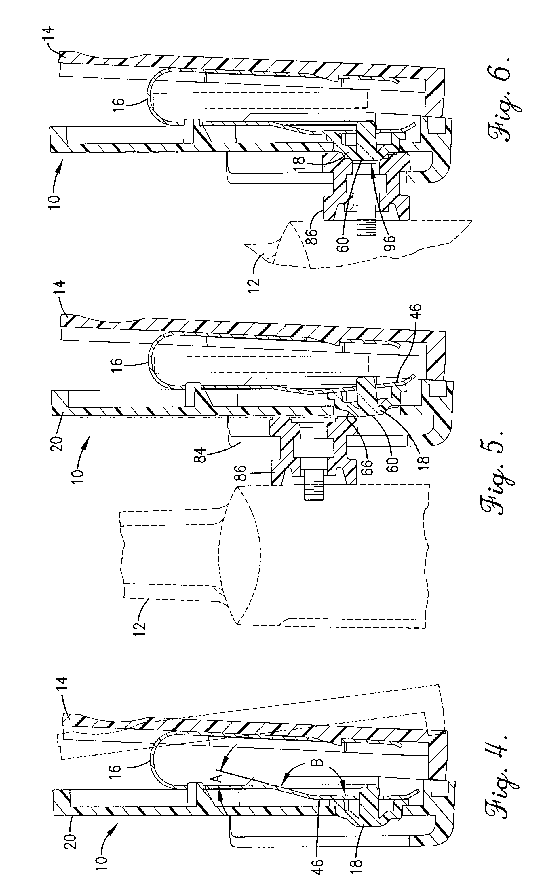 Carrying assembly and method for securement of electronic devices