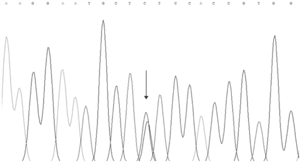 Mutated tyr gene associated with oculocutaneous albinism type 1 and its use in genetic diagnosis