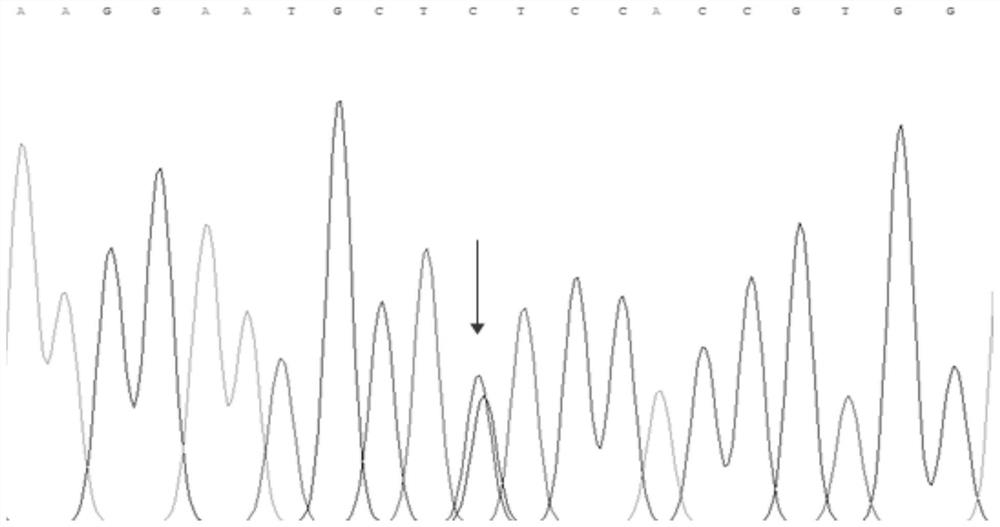 Mutated tyr gene associated with oculocutaneous albinism type 1 and its use in genetic diagnosis