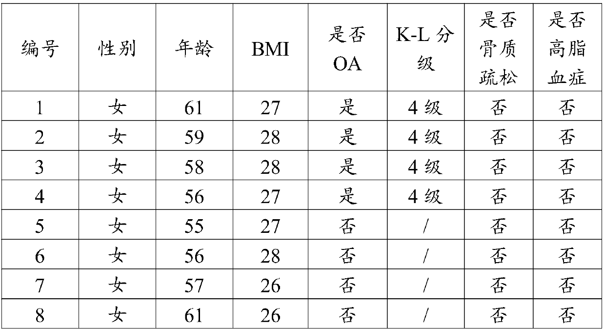 Biomarker for detecting osteoarthritis and application of biomarker