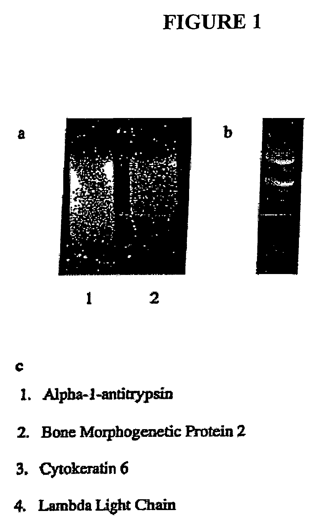 Bone morphogenetic protein-2 in the treatment and diagnosis of cancer