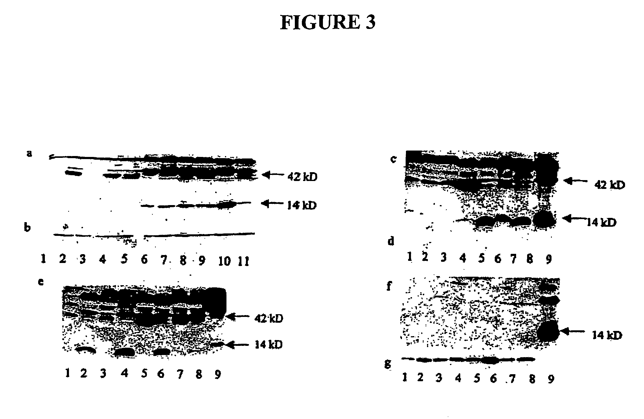 Bone morphogenetic protein-2 in the treatment and diagnosis of cancer