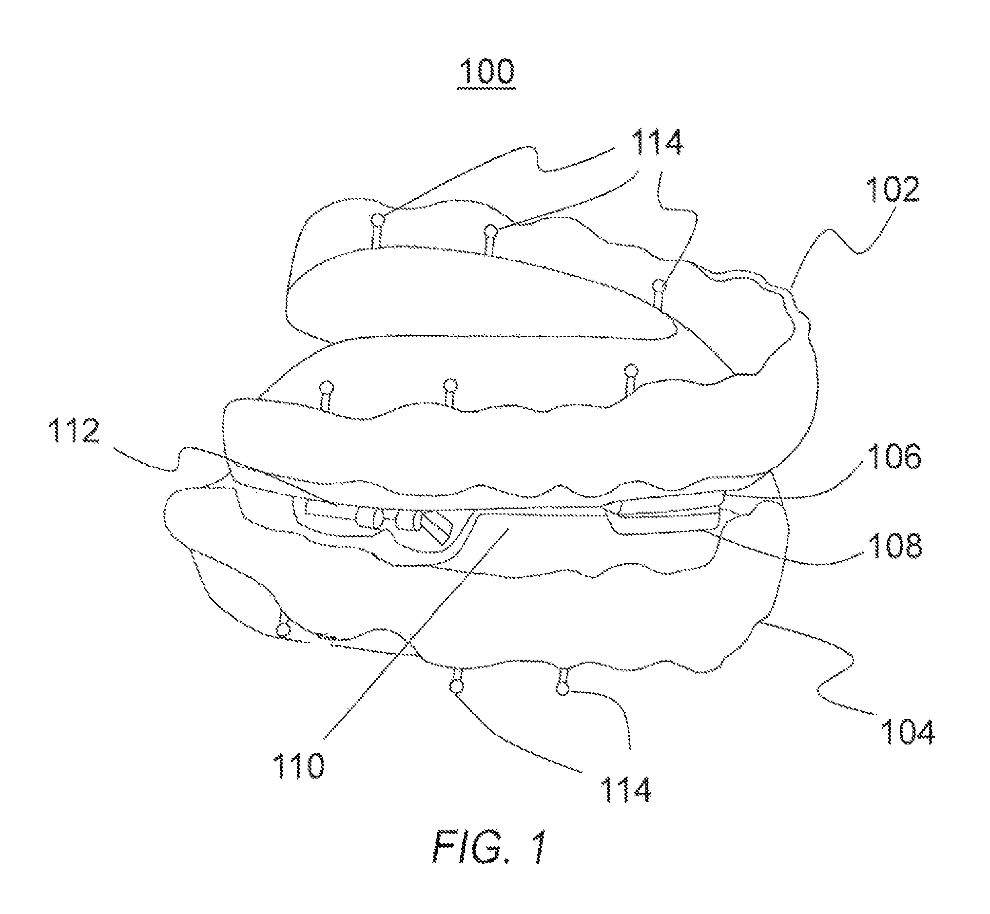 Adjustable mandibular advancement device