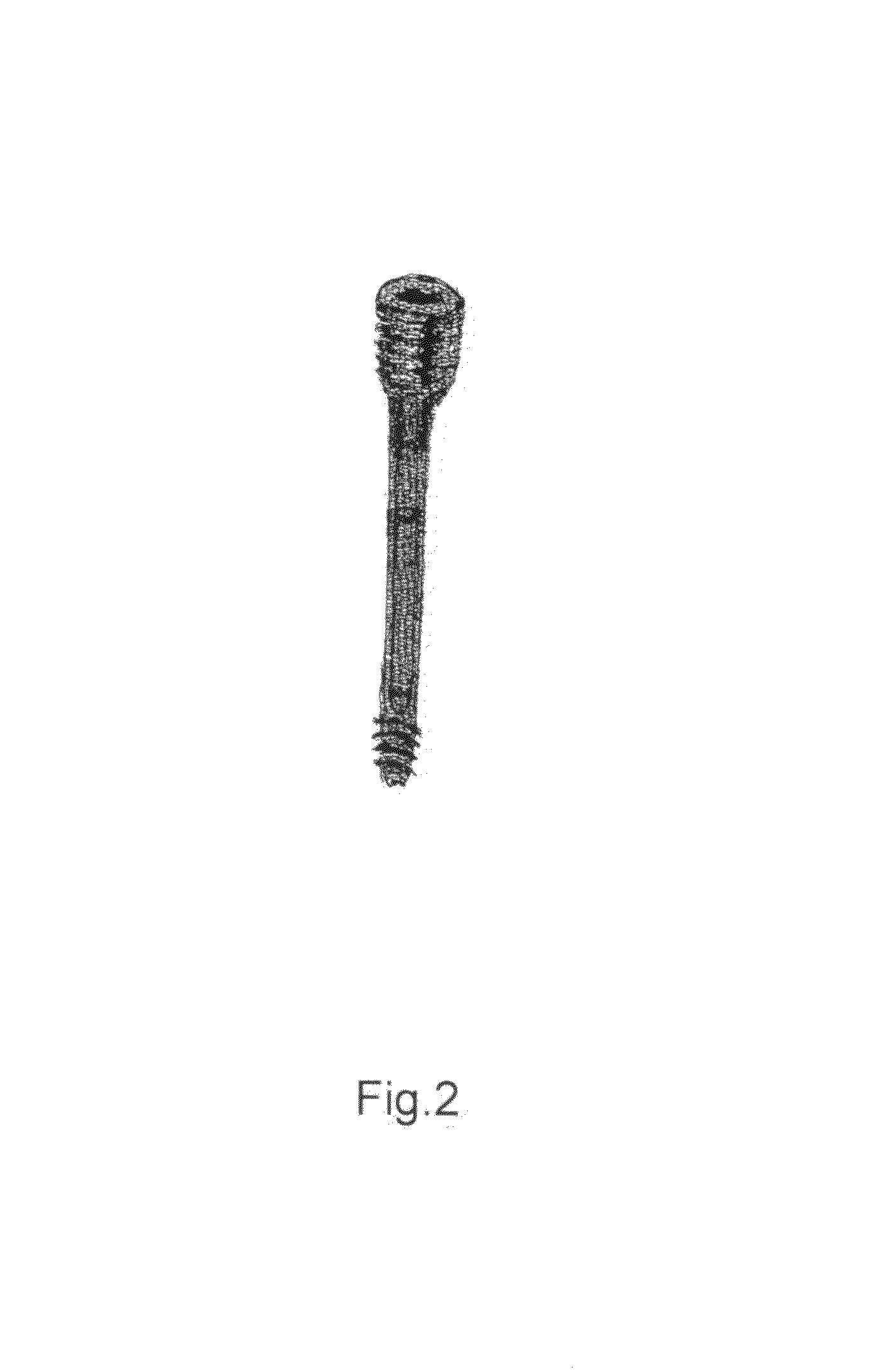 Polyporous hollow bone screw