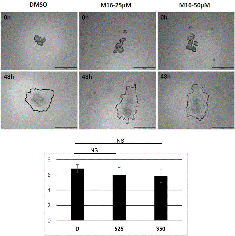 Preparation method of cancer cell ball and application