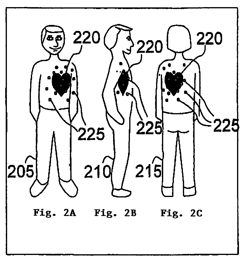 Method of and system for signal separation during multivariate physiological monitoring